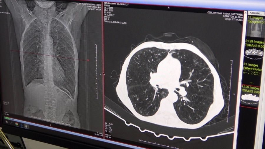 Uzman doktor, radon gazı tehlikesine karşı vatandaşları uyardı 