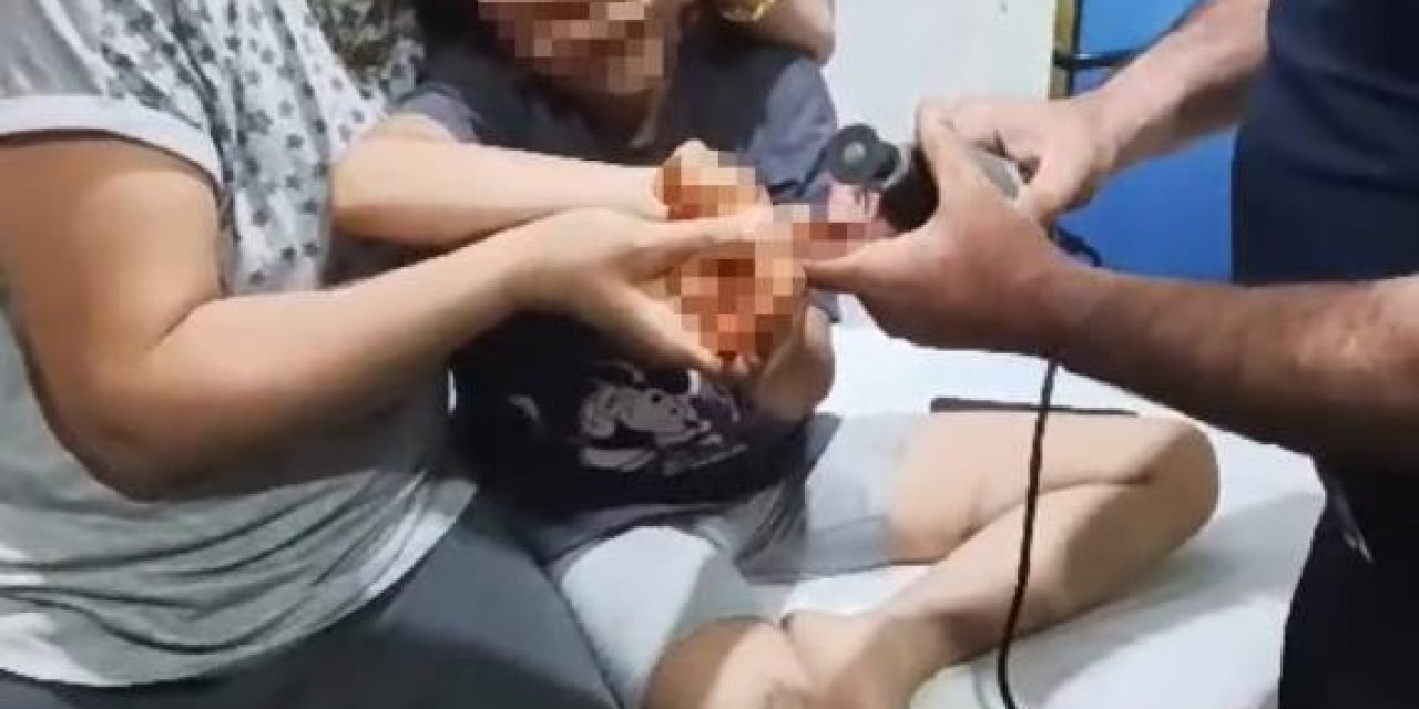 Mardin'de piknik yapan çocuğun parmağına olta iğnesi battı