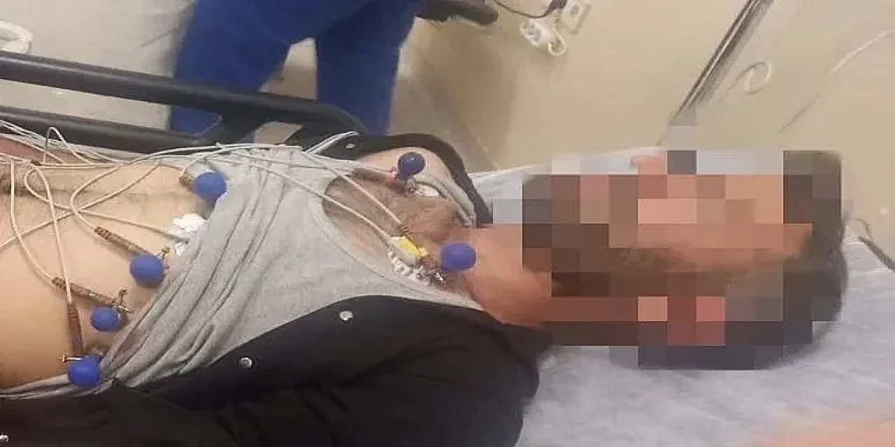 Suruç'ta korku dolu an: Bir vatandaşı tuvalette yılan ısırdı