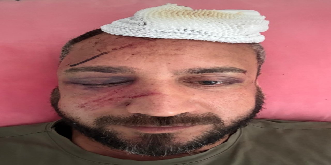 'İcraya verdiği eski sevgilisinin ailesi tarafından öldüresiye darp edildi' iddiası