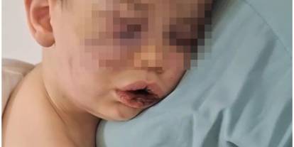 Darp sonucu hastanelik olan bebek devlet korumasına alınacak