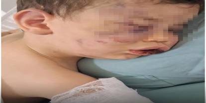 Denizli'de 2 Yaşındaki Bebek Darp Edildi!